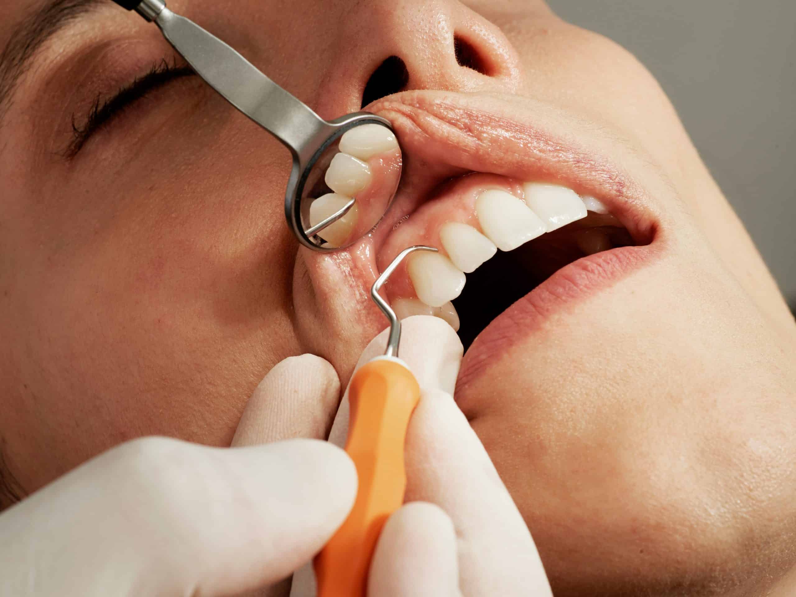 women with an oral surgeon